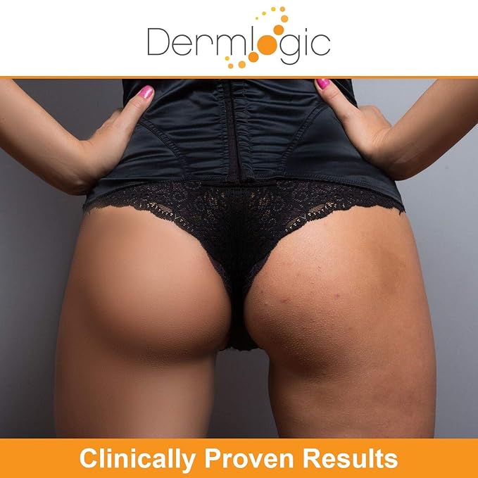 Anti-Acne Thigh & Buttocks Treatment - Clears Away Acne, Pimples, and Ingrown Hairs for the Buttocks and Thigh Area. Prevents Future Breakouts. 6.09 oz