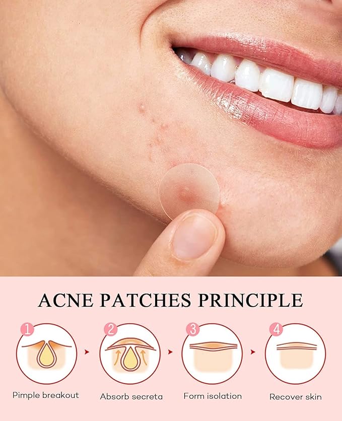 Acne Patches Pimple Patches for Face 4 Sizes 528 Count