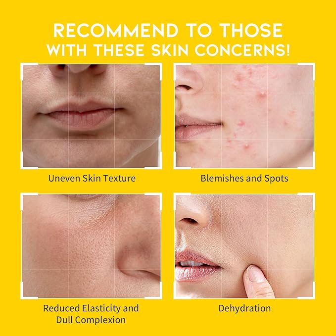 Boosting Toner Pads for Face Oily Skin Korean, #OOTD Vitamin C Niacinamide Heartleaf Hydrating Calming Redness, Vitamin C Toner Pad 70Pads 4.05oz 120ml