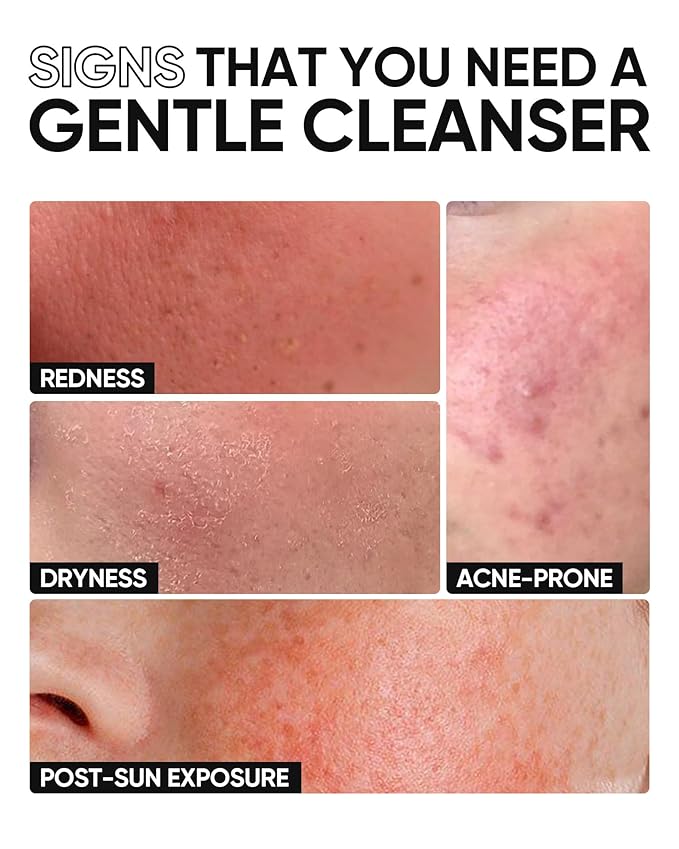 5X Ceramide Low pH Facial Cleanser, Gentle Hydrating Face Wash with Hyaluronic Acid, Daily Face Wash for Dry to Normal Skin, Sensitive Skin Tested, Not Tight, Fragrance Free