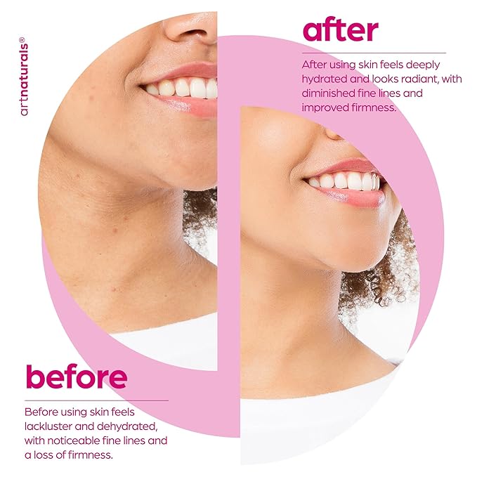 artnaturals Collagen Booster Serum for Face - Anti-Aging Reduces Wrinkles and Boosts Collagen - Heals and Repairs Skin - Improves Tone and Texture - Hyaluronic Acid & Vitamin E - 1 oz.