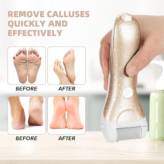 Callus Remover for Feet, Nicebirdie Electric Foot File Callus Removers Rechargeable Waterproof Pedicure Tools Foot Scrubber Shaver Feet Care Tool for Cracked Heels Dead Skin （Golden）