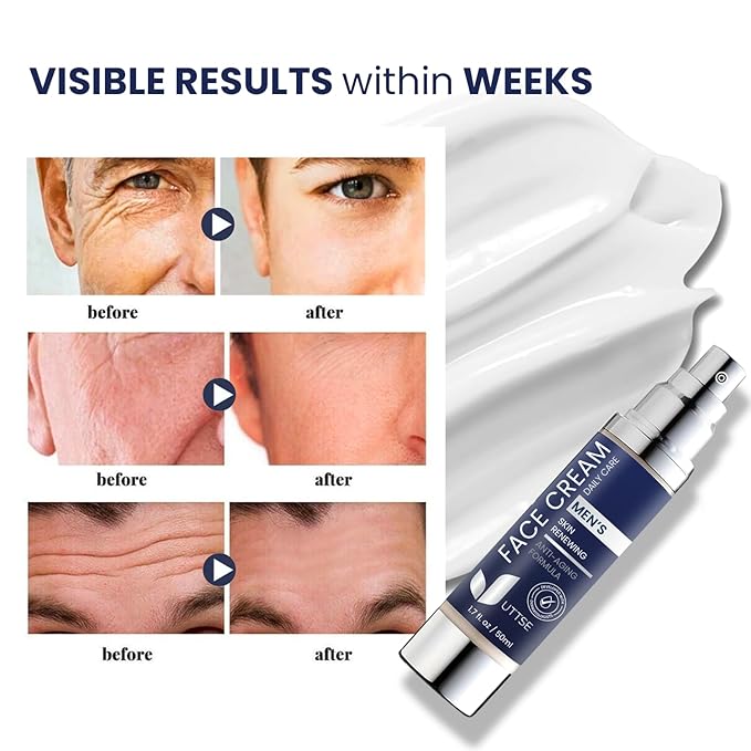 6-in-1 Face Cream for Men: Anti Aging & Wrinkle Cream for Men with Collagen, Hyaluronic Acid, Vitamins E & B, Shea Butter - Dark Spots Remover & Eye Bags Treatment - 1.7 oz.