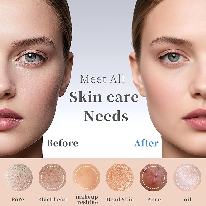 Blackhead Remover Tools, Black Head Remover for Face and Nose, Skin Scrubber Face Spatula Deep Pore Cleaner for Daily Skin Care, Skin Care Tools for Men and Women, Whitehead Removal (Green)