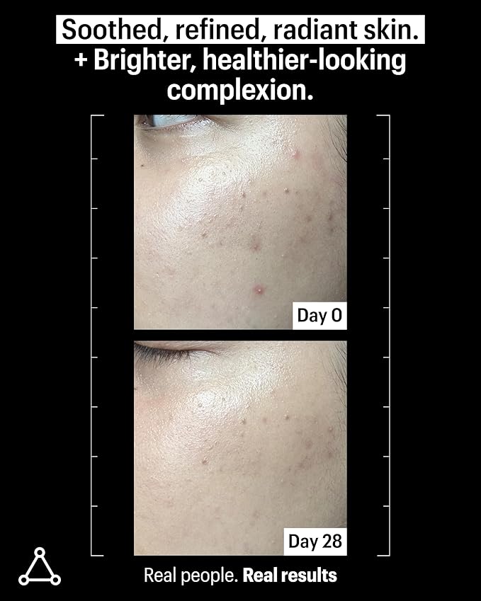 Allies of Skin 20% Vitamin C Serum | Daily Glow & Firming Face Serum | Lightweight Waterless Formula Treats Uneven Tone & Spots | Anti-Aging Support for Smooth, Radiant Skin (1 oz)