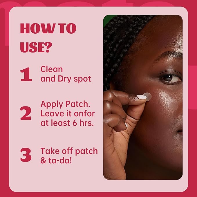 194pc Pimple Patches (192+2 Patches),3 Size with 2 Nose Hydrocolloid Acne Patches with Tea Tree Oil