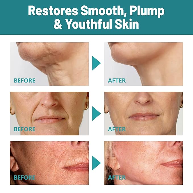 Crepes skin cream for aging skin ，Crepes Skin Repair Treatment, Firming Cream with Hyaluronic Acid & Shea Butter to Deeply Moisturize & Tighten Wrinkly Dry