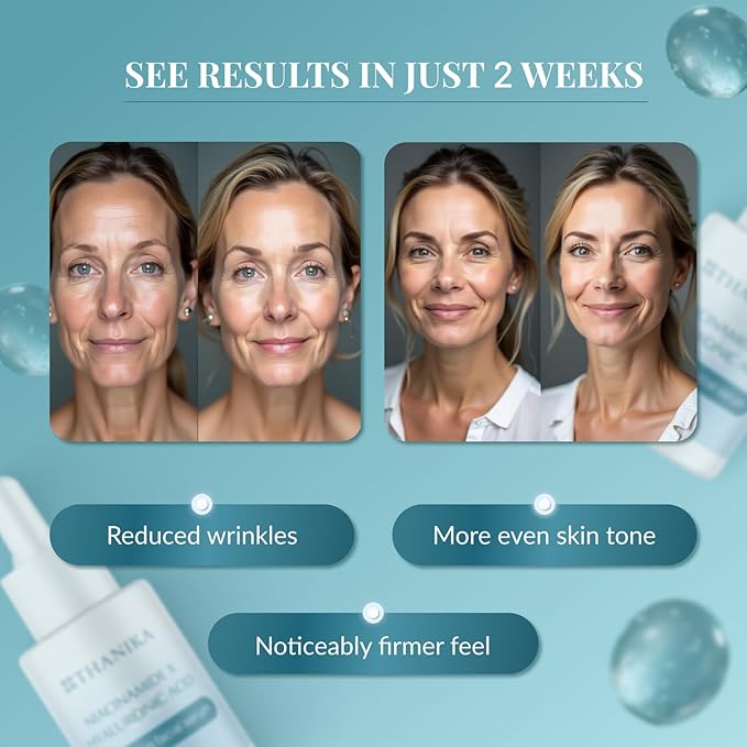 Anti Aging Hyaluronic Acid Serum with 10% Niacinamide - Face Hydration with Inulin - Lightweight Anti Aging Serum for Wrinkles, Fine Lines & Uneven Skin Texture - 1 fl oz