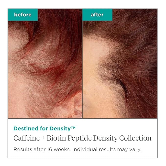 Briogeo Destined For Density Caffeine + Biotin Peptide Density Shampoo and Conditioner Set, Increases Hair Thickness and Volume for Fine or Thinning Hair, Vegan, Cruelty-Free, 2 x 8 fl oz