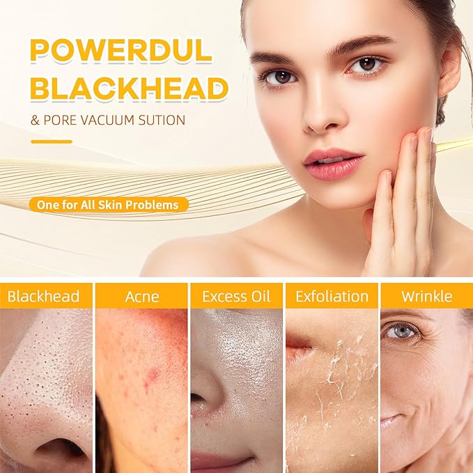 2025 Pore Vacuum with Camerafor, USB Rechargeable Blackhead Remover Vacuum,3 Levels Adjustable Pore Vacuum Blackhead Remover, 6 Suction Heads,Face Vacuum Pore Cleanser for Women & Men