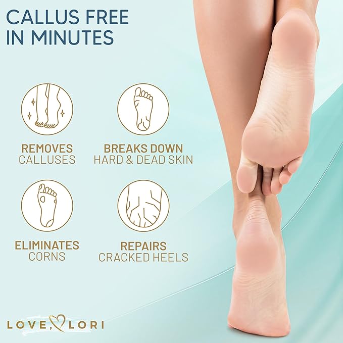Callus Remover for Feet (Extra Strength) Professional Foot Scrubber Trimmer Dead Skin Callus Gel - Pedicure Tools for Feet Spa Essential, 6oz