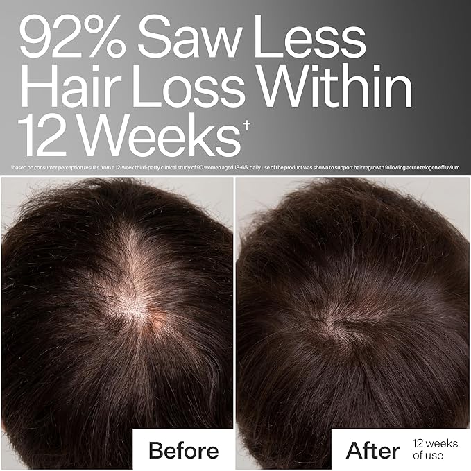 Act+Acre Cold Processed 3% Stem Cell Peptide Treatment | Boosts Hair Density | Grape Stem Cells, Peptides + Caffeine | Vegan, Fragrance-Free | 3 Fl Oz