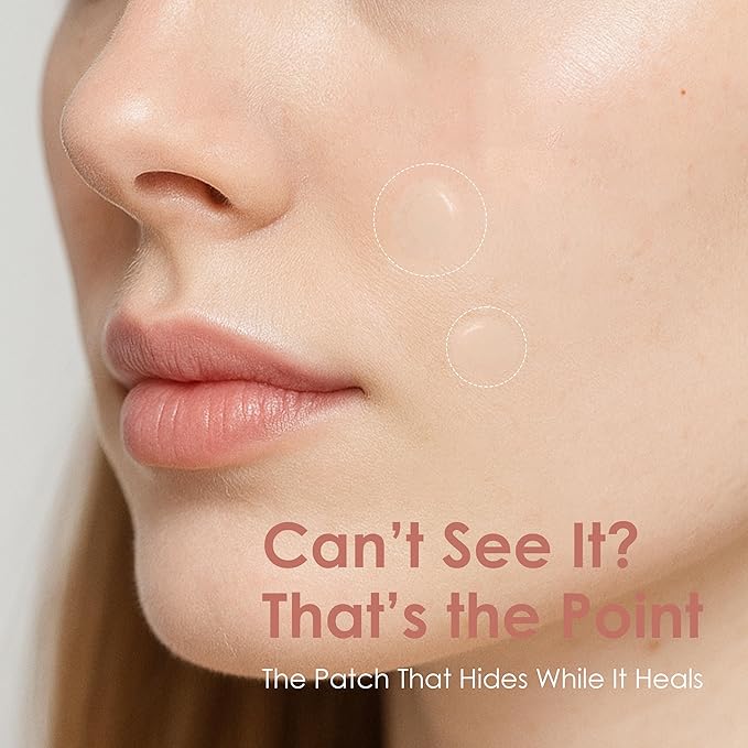 ASAP Active Spot Alleviating Patch 39 Patches [Daytime] 10mm (1 * 15ea) & 12mm (2 * 12ea) | Premium Hydrocolloid Dressing | Simple & Easy Active Treatment