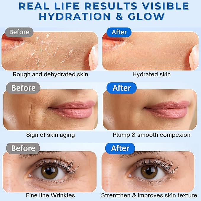 3% Hyaluronic Acid Serum, 4D Hyaluronic Acid Serum Ultra-Hydrating Vials, Hylunaric Acid Non-Greasy, Fast Absorption, Intensive Moisturizing, Deep Hydration & Smoothing (1 Box of 30 tubes)