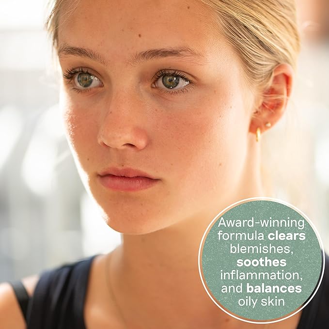 Balance Me Congested Skin Serum, Natural Acne Treatment for Face with Kanuka & Moringa, Non-Drying Spot Serum for Oily, Combination & Sensitive Skin (1 x 0.5 fl oz)