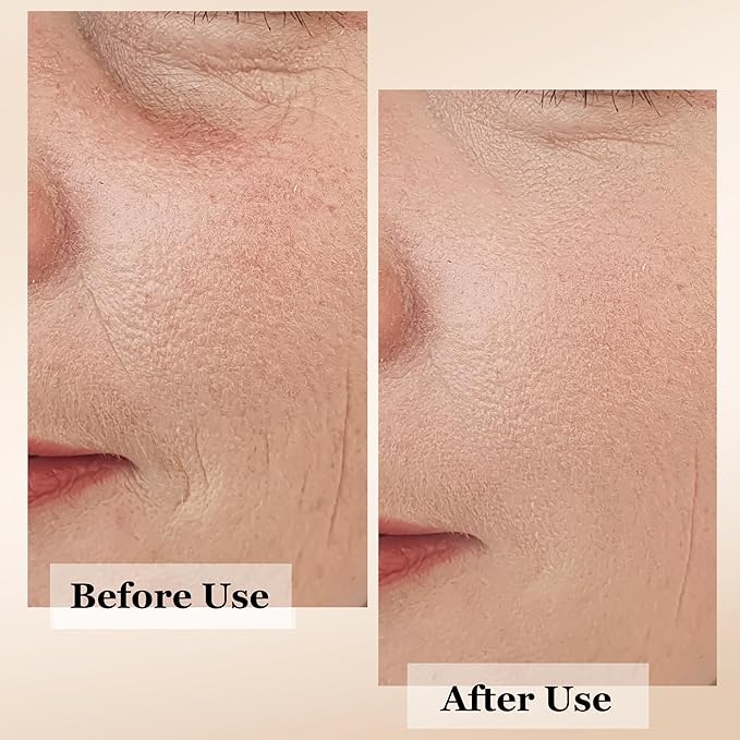 Advanced+ Super Serum with Retinol, Hyaluronic-Acid, Rosehip Oil & Vitamin C | All-In-One Anti Aging Face Serum | Brightening, Firming, AntiWrinkles, Fine Lines, Evens Tone, Healthy Glow | 1oz