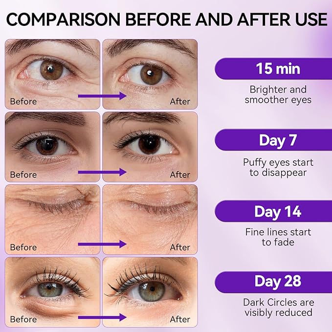 BREYLEE Retinol Eye Mask Under Eye Patches with Retinol, Collagen & Hyaluronic Acid, Reduce Puffy Eyes, Dark Circles, Wrinkles & Fine Lines, Anti-Aging Smoothing Skin Care for Women & Men - 60 Pcs