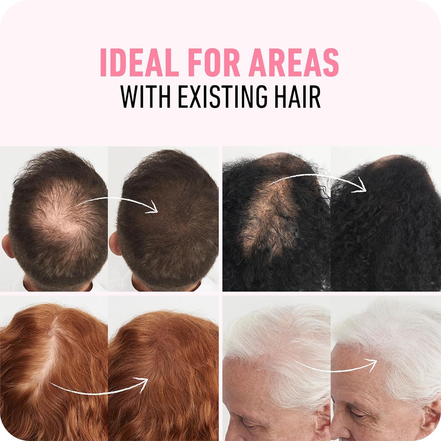 BOLDIFY Hair Fibers (56.5g) - Fill In Thinning and Fine Hair for an Instantly Fuller, Thicker Look - 14 Shades for Women & Men - Light Blonde