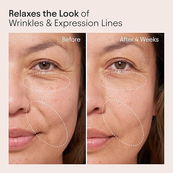 ALPYN Mini Barrier Repair Cream - Super Peptides & Ghostberry Moisturizer for Eczema I Deep Wrinkle Repair I Calm & Soothe Against Redness & Irritation - 0.5 oz / 15 ml