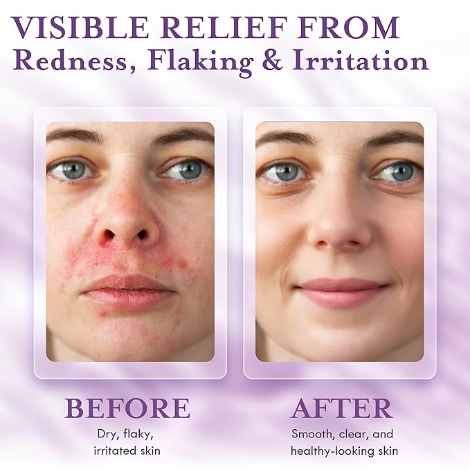 DERMAdoctor Tranquility Cleanser Dermatologist Formulated 2% Pyrithione Zinc for face body & Scalp - 7.10 oz