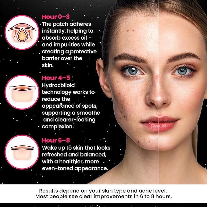 Andlane 280Pcs Star Pimple Patches for Face - Pimple Patches Cute Stars - Hydrocolloid, Salicylic Acid, Tea Tree Oil, Centella - Black Color, 3 Sizes Zit Stickers