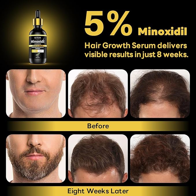 5% Minoxidil with Rosemary and Biotin for Men and Women Hair Growth,Beard Growth Kit,Scalp Serum for Thicker Fuller Hair