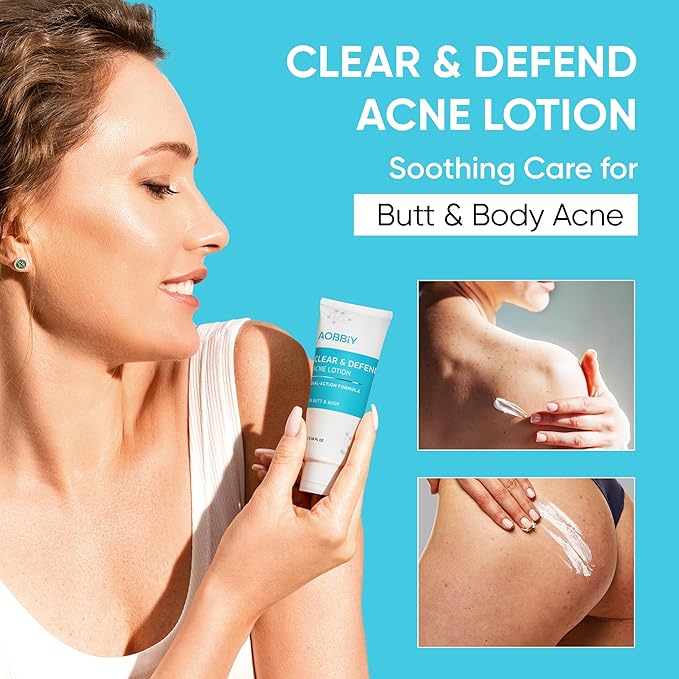 Butt Acne Clearing Treatment Cream: Clears & Prevents Breakouts Fast – Gentle Body & Back Lotion for Clogged Pores, Folliculitis & Bumps, 2% Salicylic Acid & Niacinamide, Ideal for Women, Men & Teens