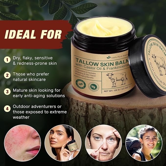 Beef Tallow for Skin & Face Cream with Castor Oil and Frankincense,120g,Organic Natural 100% Grass Fed,Whipped Beef Tallow Balm Deeply Moisturizing for Face & Body Care,4.2 oz