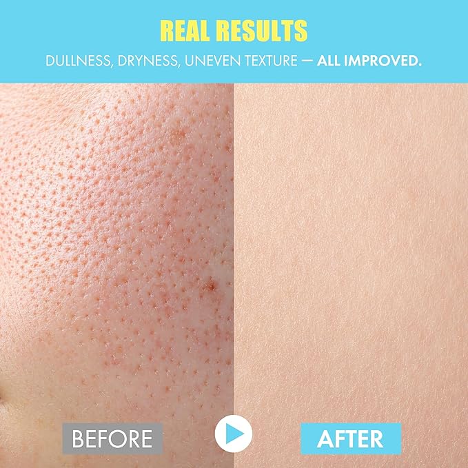 Bio-AHA Clarity Boosting Face Serum 50ml | Korean Serum w/Mild Exfoliation Fruit-Based Lactic Acids, Probiotics & Niacinamide