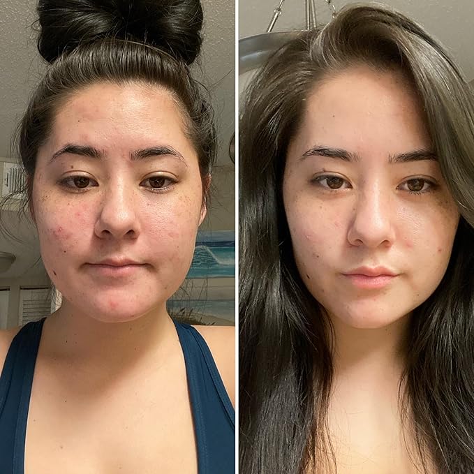 ACTIVE CLAY MASK - Ready-to-use HEALING Facial Mask & Body - HEAVY METAL FREE - 100% Natural - Blemishes, oily skin, detox, blackheads, pimples and more - 4 FL. OZ.