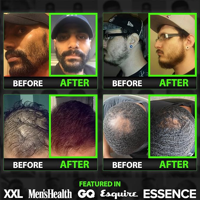 Beard Growth Kit w/ 2X Thickening Biotin Beard Balm for Men & Mustache Wax + GROW Maximum Strength Biotin 11-in-1 Hair Growth Shampoo and Conditioner for Men - Formulated in the USA