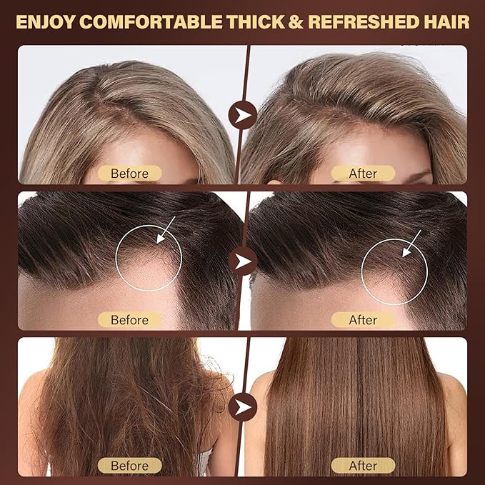 Batana Oil Products Bundle, Batana Oil Scalp Scrub and Raw Batana Oil, Strengthening, Hair Growth for Men Women with Thinning Hair or Hair Loss, Vegan, for All Hair Types