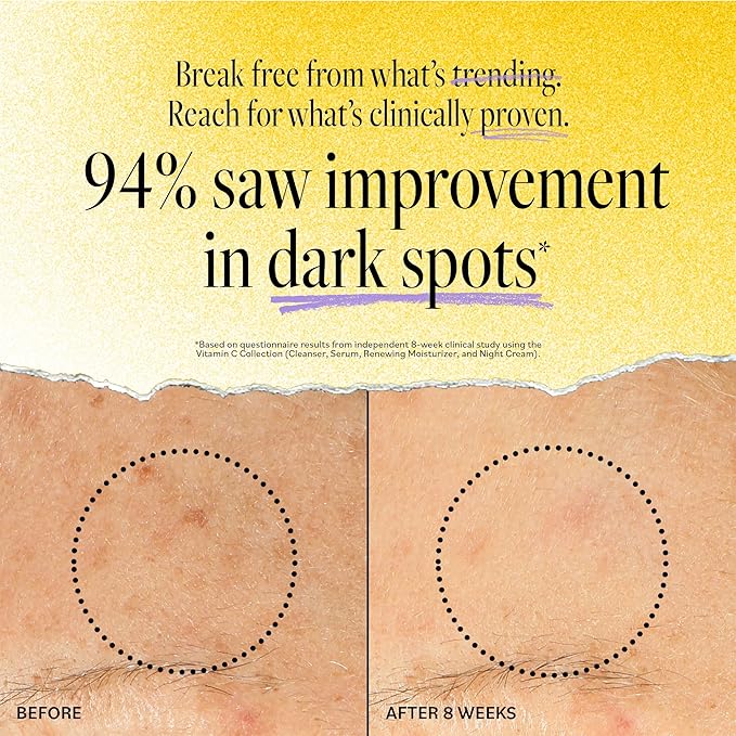 DERMA-E Vitamin C Intense Night Cream – Brightening and Hydrating Facial Skin Renewing Cream – Anti-Aging Overnight Facial Moisturizer, 2 oz